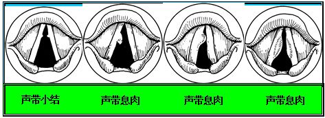 電子喉價(jià)格